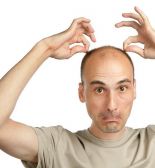 Особенности процедуры пересадки волос