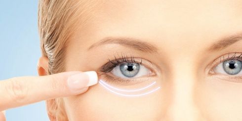 Блефаропластика верхних и нижних век