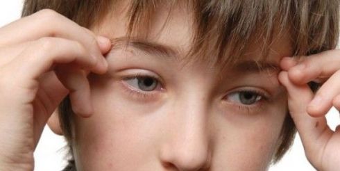 Варикоцеле у подростков: профилактика и лечение