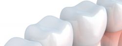 Зубная имплантация: полноценная замена утраченных зубов