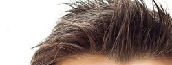 Пересадка волос: как и где, чтобы волосы жили долго