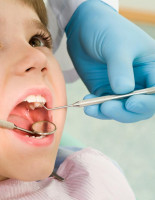 Почему на молочных зубах возникает кариес и как его лечить