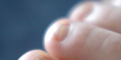 Ученые научились по ногтям определить риск рака легких