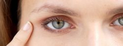 Что вызывает морщины глаз?